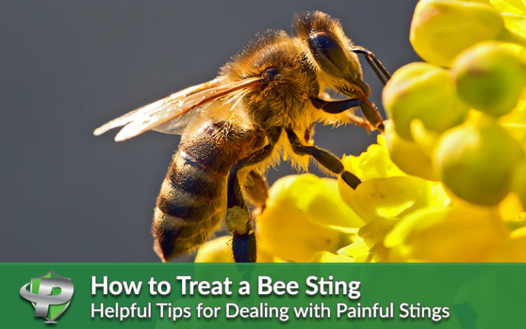 Tips to deal with bee sting
